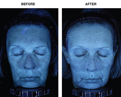 Skin Memory Serum - Crex